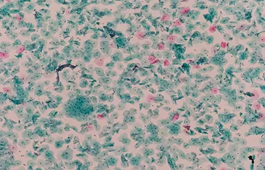 عامل هایی که بر روی نابود کردن اسلایدهای لکه دار هستند