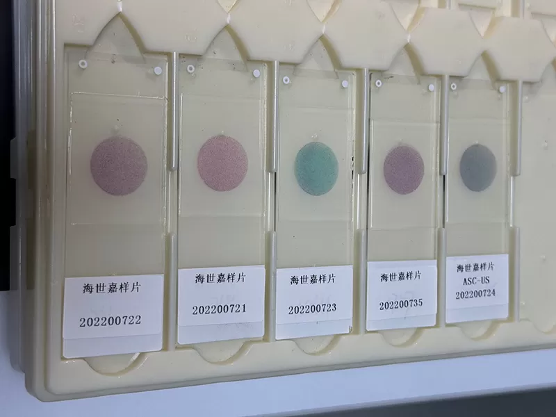 pap-stained-slide.jpg pap-stained-slide.jpg